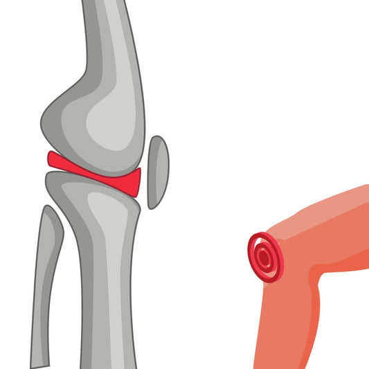 Total Knee Replacement - All The Journey - Medical Arts Shop