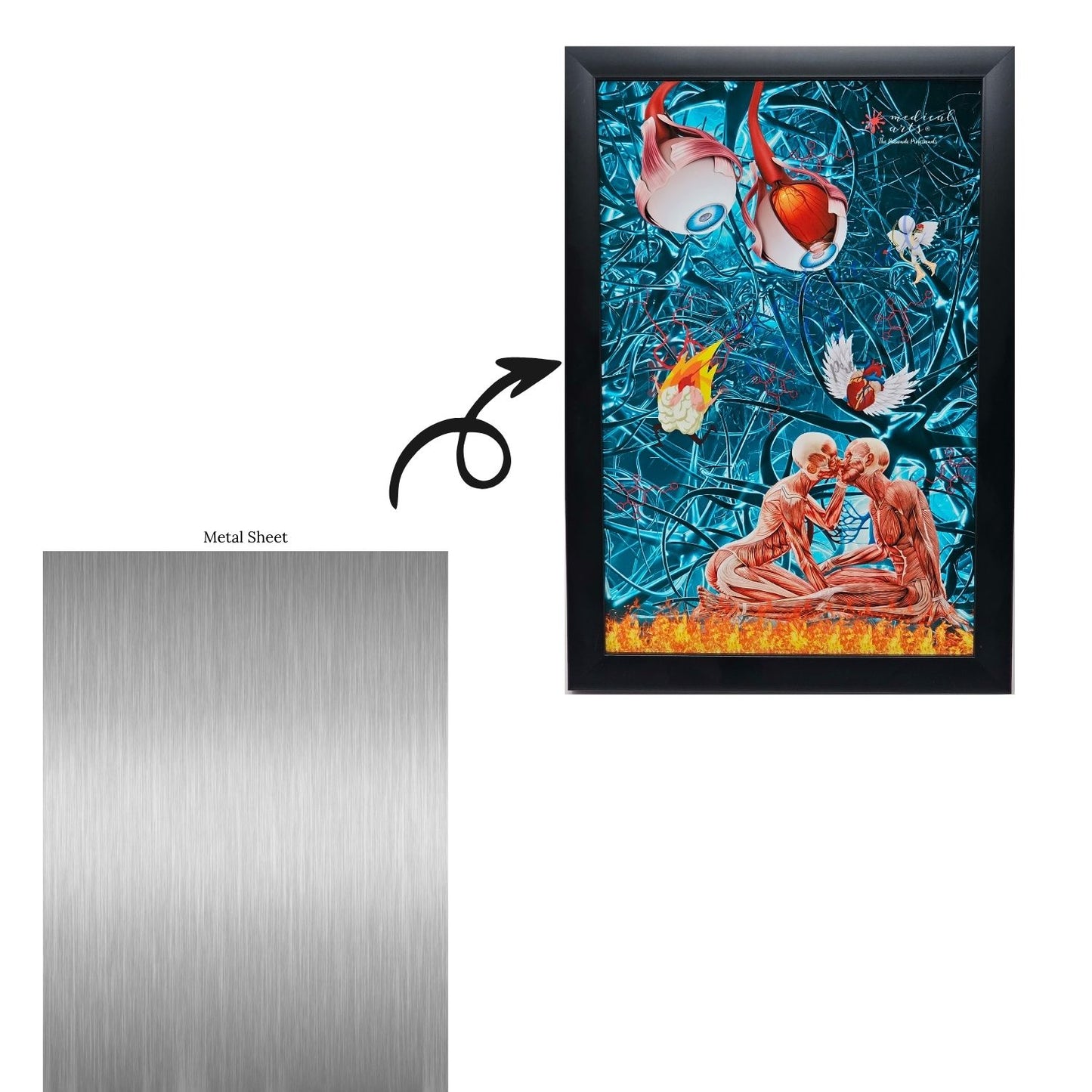 Medical Arts Metal Plate Poster - Storytelling - Pathophysiology of Love