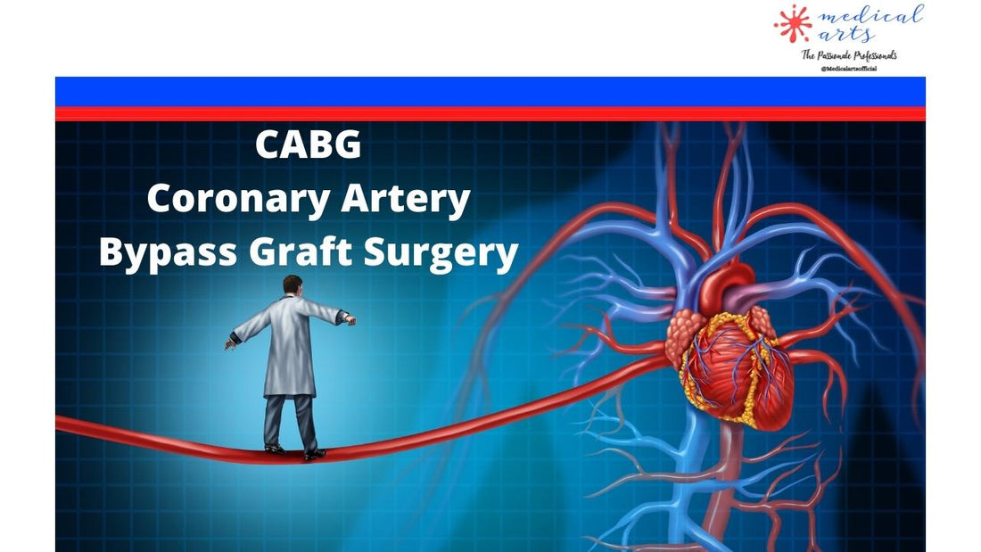 CABG - Coronary Artery Bypass Surgery - Medical Arts Shop