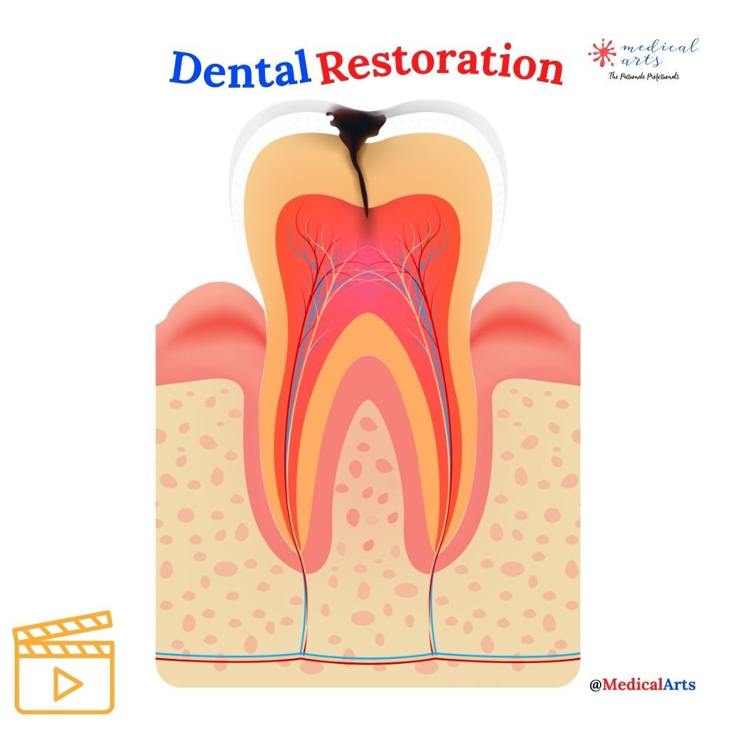 Dental Restoration ↪ Composite Bonding Teeth ↪ Medical Arts - Medical Arts Shop