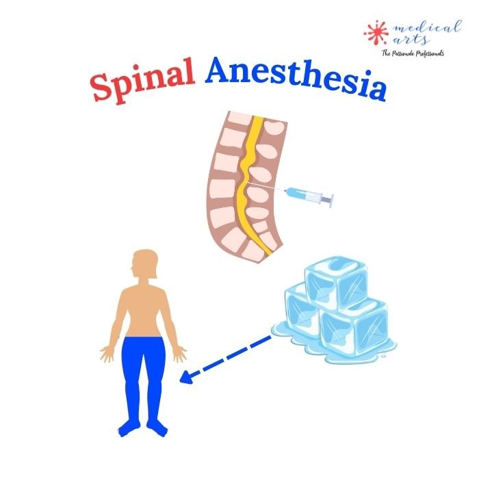 Epidural [] Spinal Anesthesia [] Lumbar Puncture - Medical Arts Shop
