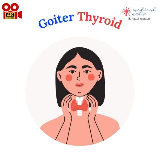 Goiter: An Insightful Overview for Professionals and Patients - Medical Arts Shop