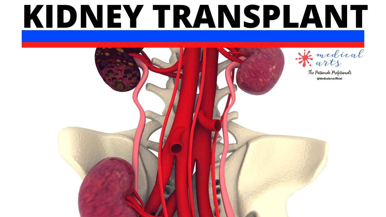 Kidney Transplant: What, Why and how.