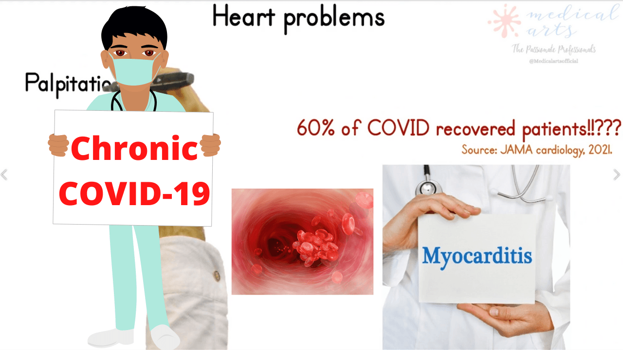 LONG COVID SYNDROME - Major health problems of the near future.