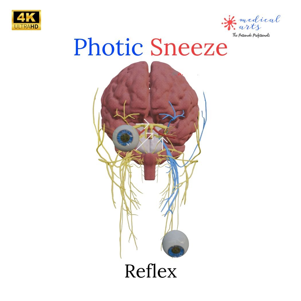 Sun Sneezing 🤧 Photic sneeze ☀️ Photic Sneeze Reflex - Video included