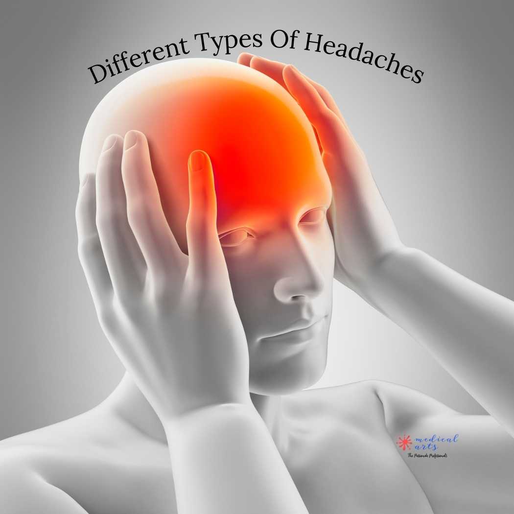 The Different Types of Headaches: Tension Type, Cluster, and Beyond - Medical Arts Shop