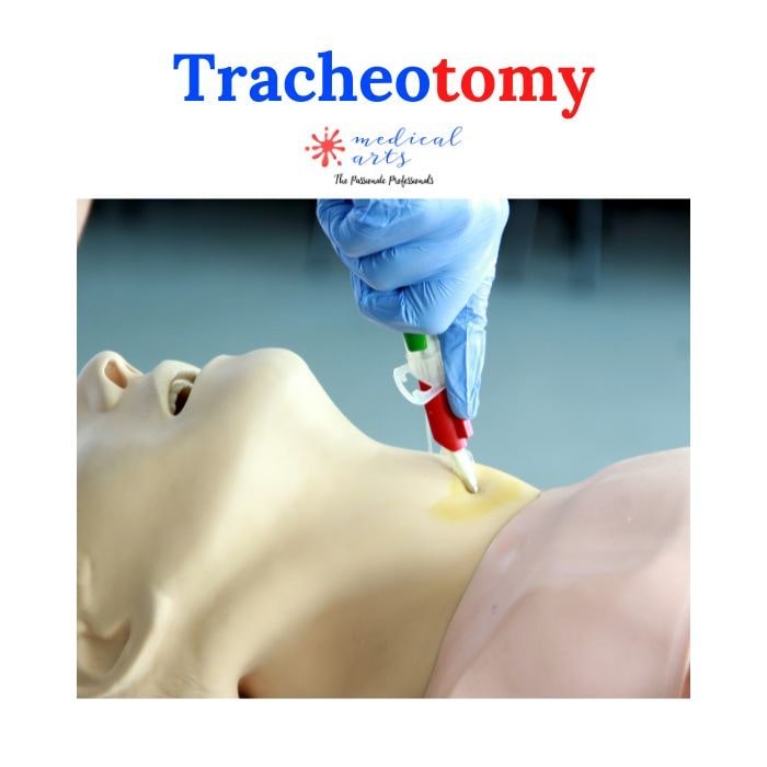Tracheostomy, tracheotomy procedure explained & 3D animation - Medical Arts Shop