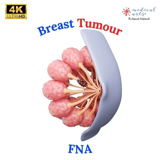 Understanding Breast Lumps & FineNeedle Aspiration FNA 🎥 - Medical Arts Shop